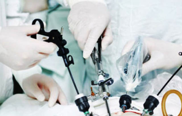 Intervențiile chirurgicale minim invazive complexe, realizate în Secția Chirurgie II a SCJU Sibiu