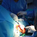 Intervenţie chirurgicală ortopedică complexă de protezare totală a umărului realizată la SCJU Sibiu