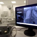 Noi dotări pentru radiologia Spitalului Clinic Județean de Urgență Sibiu: aparat ultra-performant de radiologie și radioscopie digitală