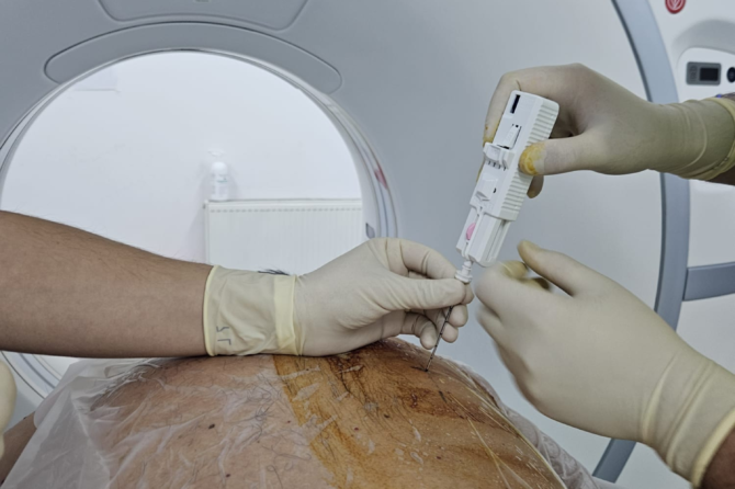 Premieră la Spitalul Clinic Județean de Urgență Sibiu: A fost efectuată prima biopsie pulmonară ghidată prin computerul tomograf (CT)