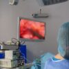 Intervenție în premieră la Spitalul Clinic Județean de Urgență Sibiu, pentru pacienții bolnavi de cancer rectal