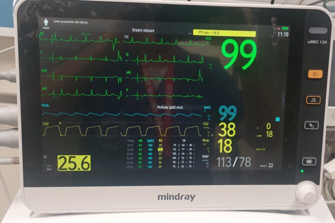 Camera de Resuscitare a UPU Sibiu, dotată cu un monitor multiparametric avansat de funcții vitale